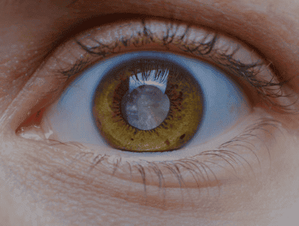 eye Group conditions