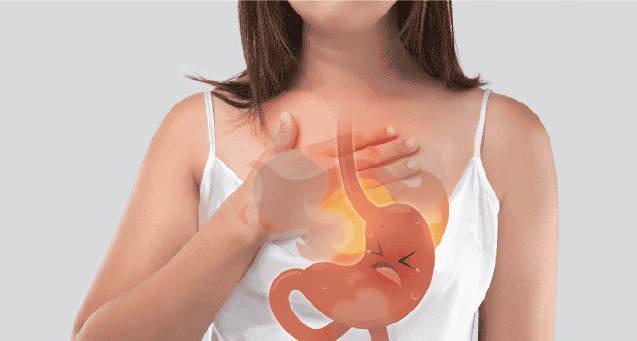  gastro esophagageal reflux disease
